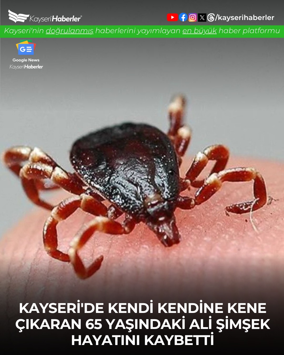 Kayseri'de Kene Çıkarmaya Çalışırken Yaşamını Yitiren Vatandaş