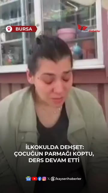 Bursa'da İlkokul Öğrencisinin Parmağı Koptu: Öğretmen İhmal İddiası